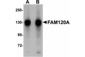 Image no. 1 for anti-Family with Sequence Similarity 120A (FAM120A) (Internal Region) antibody (ABIN478146) (FAM120A anticorps  (Internal Region))