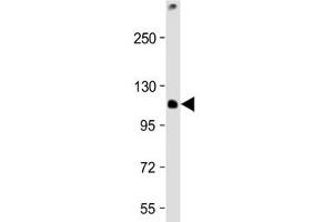Western blot testing of mouse EL4 cell lysate with TCIRG1 antibody at 1:2000.