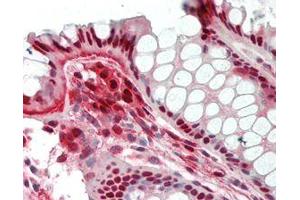 Immunohistochemical staining of Nampt using anti-Nampt (Visfatin/PBEF), mAb (OMNI379)  in formalin-fixed and paraffin-embedded (FFPE) human colon tissue (15µg/ml). (NAMPT anticorps  (Biotin))