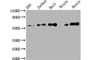 Western Blot Positive WB detected in: 293 whole cell lysate, Jurkat whole cell lysate, Raji whole cell lysate, Mouse brain tissue, Rat brain tissue All lanes: PAK2 antibody at 1:2000 Secondary Goat polyclonal to rabbit IgG at 1/50000 dilution Predicted band size: 59 kDa Observed band size: 59 kDa (Recombinant PAK2 anticorps)
