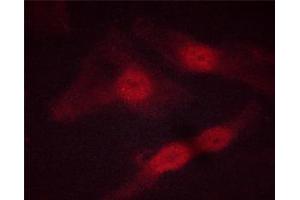 anti-STAT5 A/B (STAT5 A/B) (pSer725), (pSer730) antibody