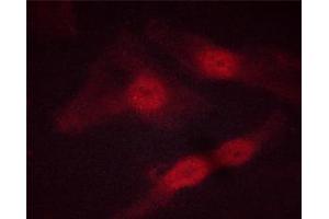 ABIN6267513 staining HeLa cells by ICC/IF.