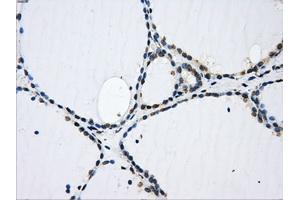 Immunohistochemical staining of paraffin-embedded pancreas tissue using anti-GBE1 mouse monoclonal antibody. (GBE1 anticorps)