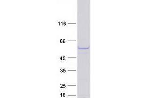 Validation with Western Blot