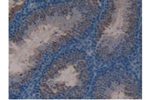 IHC-P analysis of Mouse Testis Tissue, with DAB staining. (Lactoferrin anticorps  (AA 63-193))