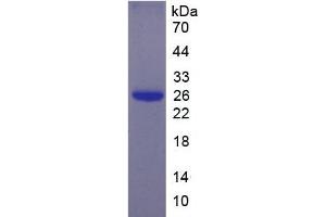 SDS-PAGE analysis of Human EBI3 Protein. (EBI3 Protéine)