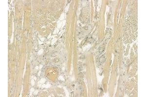 ABIN6260106 and ABIN6276528 at 1/100 staining human tongue carcinoma by IHC-P. (ATG4C anticorps  (N-Term))