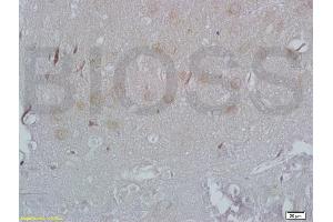 Formalin-fixed and paraffin embedded rat brain labeled with Rabbit Anti ADRB3/beta 3 Adrenergic Receptor Polyclonal Antibody, Unconjugated (ABIN737106) at 1:200 followed by conjugation to the secondary antibody and DAB staining