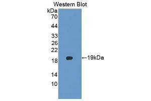 Western blot analysis of the recombinant protein. (PLTP anticorps  (AA 337-479))