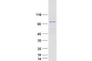 Validation with Western Blot