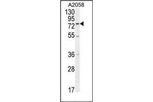 Western blot analysis of ENTHD1 Antibody (N-term) in A2058 cell line lysates (35ug/lane). (ENTHD1 anticorps  (N-Term))