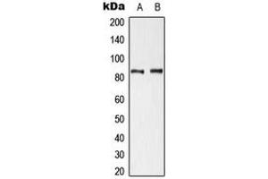 Western blot analysis of Cortactin (pY421) expression in HeLa UV-treated (A), NIH3T3 H2O2-treated (B) whole cell lysates. (Cortactin anticorps  (pTyr421))