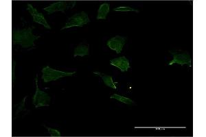 Immunofluorescence of monoclonal antibody to RHOC on HeLa cell.