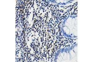Immunohistochemistry of paraffin-embedded human colon using PIM1 antibody (ABIN7269375) at dilution of 1:100 (40x lens).