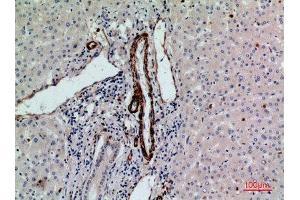 Immunohistochemistry (IHC) analysis of paraffin-embedded Human Liver, antibody was diluted at 1:100.