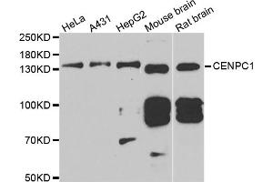Western blot analysis of extracts of various cell lines, using CENPC antibody. (Centromere Protein C Pseudogene 1 (CENPCP1) anticorps)