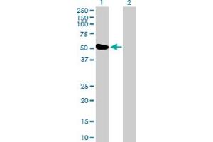 Western Blot analysis of ZBTB26 expression in transfected 293T cell line by ZBTB26 MaxPab polyclonal antibody. (ZBTB26 anticorps  (AA 1-441))