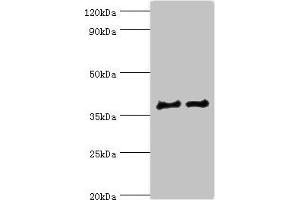 Western blot All lanes: CTSV antibody at 12 μg/mL Lane 1: Jurkat whole cell lysate Lane 2: MCF-7 whole cell lysate Secondary Goat polyclonal to rabbit IgG at 1/10000 dilution Predicted band size: 37 kDa Observed band size: 37 kDa (Cathepsin L2 anticorps  (AA 105-334))