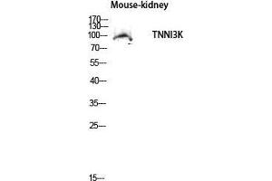 Western Blot (WB) analysis of Mouse Kidney lysis using TNNI3K antibody. (TNNI3K anticorps  (Internal Region))