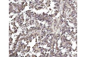 IHC analysis of TRIM24 using anti-TRIM24 antibody (ABIN7602358). (TRIM24 anticorps  (AA 706-964))