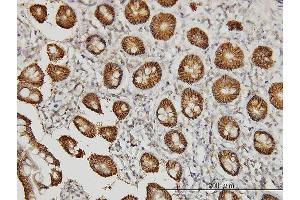 Immunoperoxidase of monoclonal antibody to CLDN1 on formalin-fixed paraffin-embedded human small Intestine.
