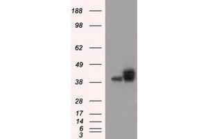 Image no. 2 for anti-Basigin (Ok Blood Group) (BSG) antibody (ABIN1498015) (CD147 anticorps)