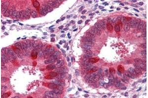 Human Uterus: Formalin-Fixed, Paraffin-Embedded (FFPE)