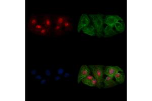 ABIN7094736 and ABIN7098787 staining  cells by IF/ICC. (OVOL2 anticorps  (Internal Region))