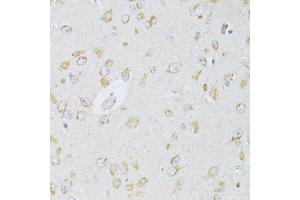 Immunohistochemistry of paraffin-embedded rat brain using NTS antibody (ABIN6290694) at dilution of 1:100 (40x lens). (Neurotensin anticorps)