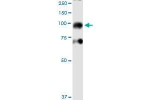 IKBKB monoclonal antibody (M04), clone 1A3.