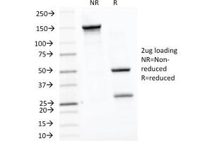 SDS-PAGE Analysis Purified HSP60 Mouse Monoclonal Antibody (LK1).