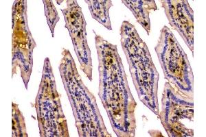 IHC analysis of CA2 using anti-CA2 antibody (ABIN6719533). (CA2 anticorps  (AA 2-260))