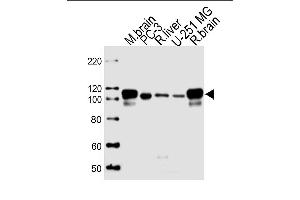 Lane 1: mouse brain lysates, Lane 2: PC-3 Cell lysates, Lane 3: rat liver Cell lysates, Lane 4: U-251 MG Cell lysates, Lane 5: rat brain Cell lysates, probed with USP5 (1340CT704. (USP5 anticorps)