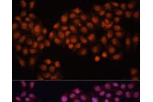 Immunofluorescence analysis of HeLa cells using CDC25A Polyclonal Antibody at dilution of 1:100 (40x lens). (CDC25A anticorps)