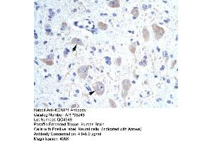 Human Brain (KCNIP1 anticorps  (N-Term))