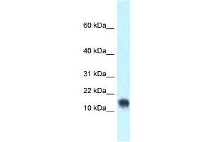 WB Suggested Anti-Lynx1 Antibody Titration: 1. (LYNX1 anticorps  (Middle Region))