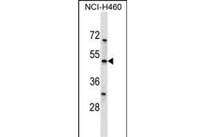KCNK12 Antibody (C-term) (ABIN1537158 and ABIN2849703) western blot analysis in NCI- cell line lysates (35 μg/lane). (KCNK12 anticorps  (C-Term))