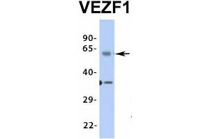 Host:  Rabbit  Target Name:  VEZF1  Sample Type:  Human Fetal Lung  Antibody Dilution:  1.