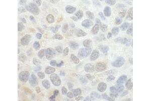 Immunohistochemistry (IHC) image for anti-SRSF Protein Kinase 1 (SRPK1) (AA 275-325) antibody (ABIN7448815) (SRPK1 anticorps  (AA 275-325))