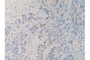 Figure. (SIRPA anticorps  (AA 105-324))