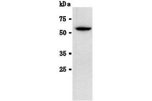 Western Blotting (WB) image for anti-Luciferase antibody (ABIN1108070) (Luciferase anticorps)