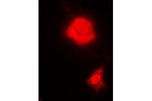 Immunofluorescent analysis of RBFOX3 staining in MCF7 cells. (NeuN anticorps)