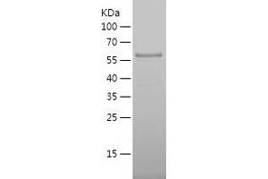 Western Blotting (WB) image for Melanoma Antigen Family A, 10 (MAGEA10) (AA 1-369) protein (His tag) (ABIN7123883)