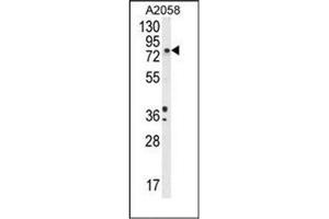 Western blot analysis of DBH Antibody (N-term) in A2058 cell line lysates (35ug/lane). (DBH anticorps  (N-Term))