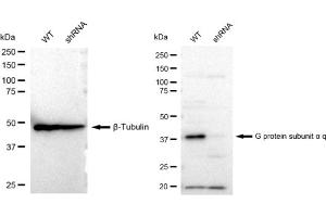 Western blotting analysis using G protein subunit alpha q antibody (ABIN7800932).