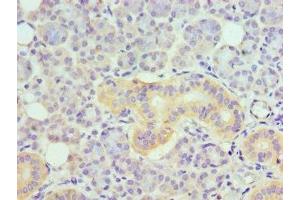 Immunohistochemistry of paraffin-embedded human pancreatic tissue using ABIN7173876 at dilution of 1:100 (TNFRSF21 anticorps  (AA 371-655))