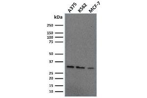 Western Blot Analysis of Human A375, K562, MCF-7 cell lysate using Replication Protein A2 Mouse Monoclonal Antibody (RPA2/2106). (RPA2 anticorps)