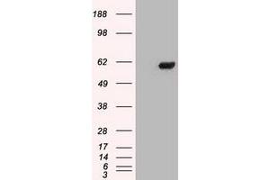 Image no. 4 for anti-Checkpoint Kinase 2 (CHEK2) antibody (ABIN1497499) (CHEK2 anticorps)