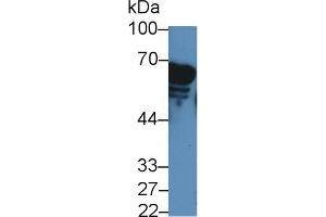 Detection of AMY2A in Rat Serum using Polyclonal Antibody to Amylase, Alpha 2A (AMY2A) (AMY2A anticorps  (AA 201-473))