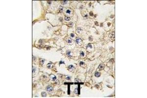 Formalin-fixed and paraffin-embedded human testis tissue reacted with EPHA10 antibody (N-term), which was peroxidase-conjugated to the secondary antibody, followed by DAB staining.